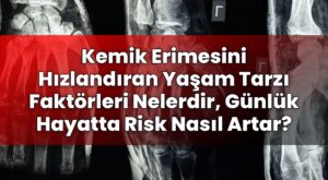Kemik Erimesini Hızlandıran Yaşam Tarzı Faktörleri Nelerdir, Günlük Hayatta Risk
Nasıl Artar?