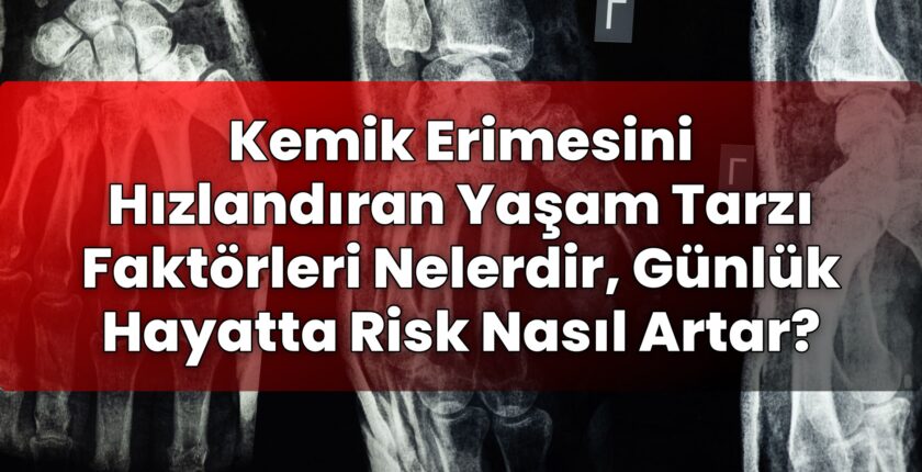 Kemik Erimesini Hızlandıran Yaşam Tarzı Faktörleri Nelerdir, Günlük Hayatta Risk
Nasıl Artar?