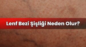 Lenf Bezi Şişliği Neden Olur?