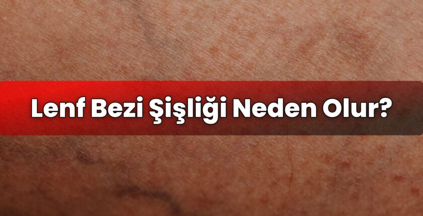Lenf Bezi Şişliği Neden Olur?