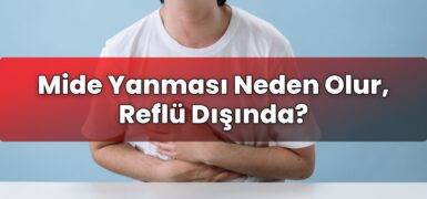 Mide Yanması Neden Olur, Reflü Dışında?