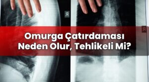Omurga Çatırdaması Neden Olur, Tehlikeli Mi?