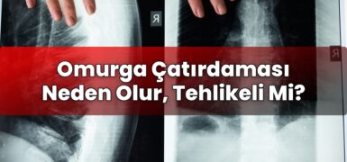 Omurga Çatırdaması Neden Olur, Tehlikeli Mi?