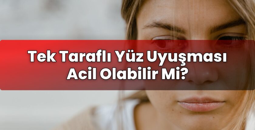 Tek Taraflı Yüz Uyuşması Acil Olabilir Mi?