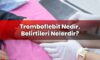 Tromboflebit Nedir, Belirtileri Nelerdir?