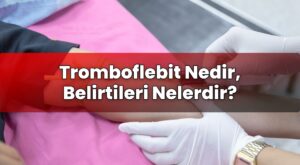 Tromboflebit Nedir, Belirtileri Nelerdir?
