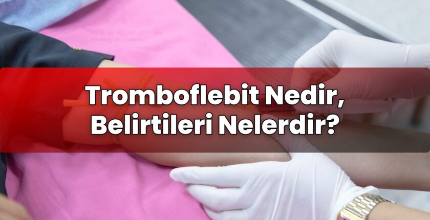 Tromboflebit Nedir, Belirtileri Nelerdir?