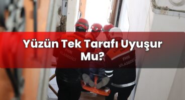 Yüzün Tek Tarafı Uyuşur Mu?