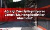 Ağız İçi Yara İyileşmiyorsa Zararlı Mı, Hangi Belirtiler Alarmdır?