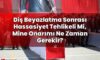 Diş Beyazlatma Sonrası Hassasiyet Tehlikeli Mi, Mine Onarımı Ne Zaman Gerekir?