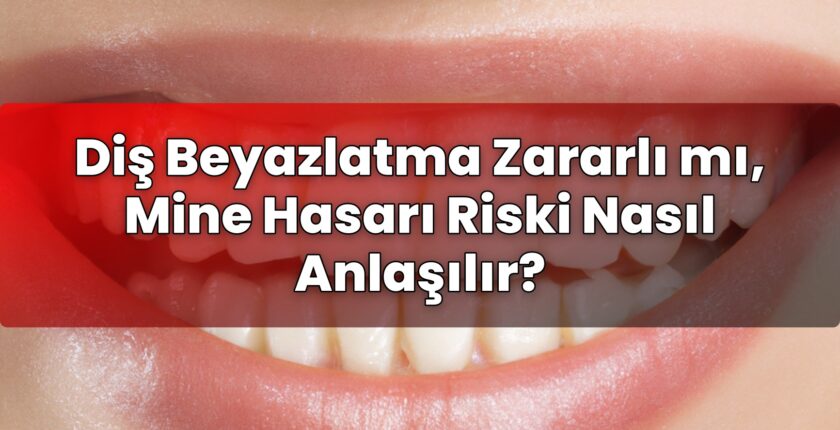 Diş Beyazlatma Zararlı mı, Mine Hasarı Riski Nasıl Anlaşılır?