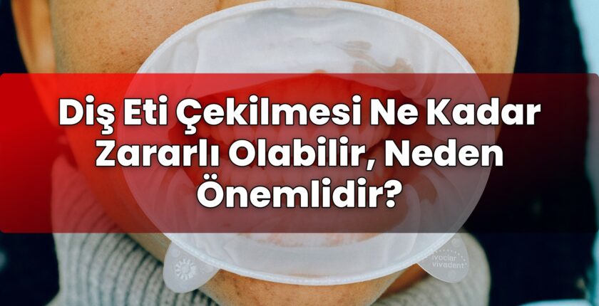 Diş Eti Çekilmesi Ne Kadar Zararlı Olabilir, Neden Önemlidir?