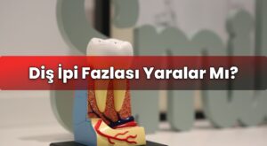 Diş İpi Fazlası Yaralar Mı?