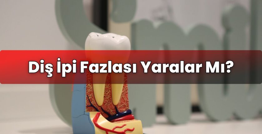 Diş İpi Fazlası Yaralar Mı?