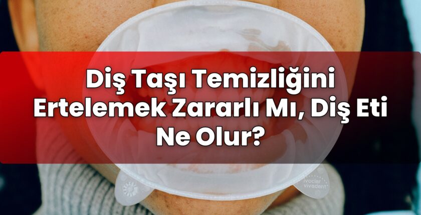 Diş Taşı Temizliğini Ertelemek Zararlı Mı, Diş Eti Ne Olur?