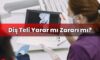Diş Teli Yarar mı Zararı mı?