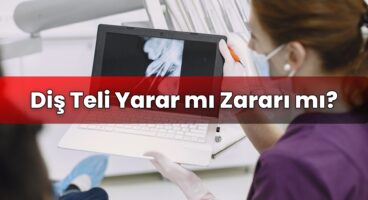 Diş Teli Yarar mı Zararı mı?