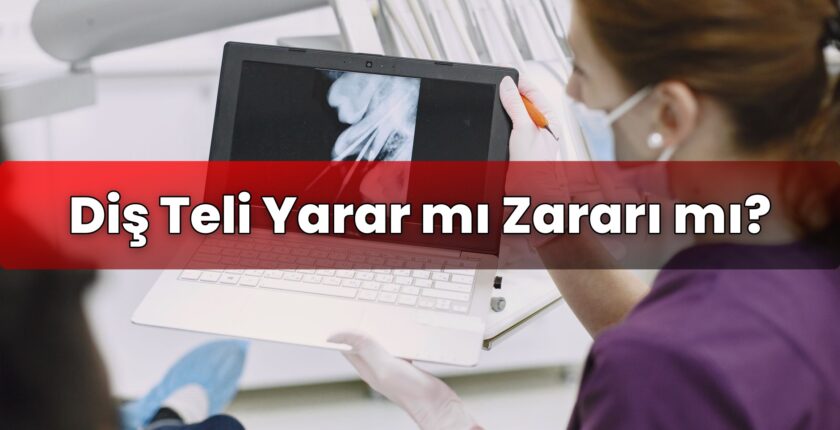 Diş Teli Yarar mı Zararı mı?
