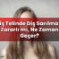 Diş Telinde Diş Sarılması Zararlı mı, Ne Zaman Geçer?