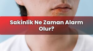 Sakinlik Ne Zaman Alarm Olur?